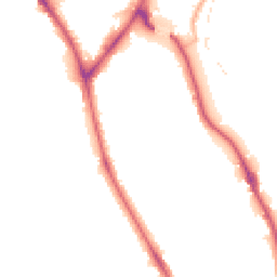 Night-time road noise heatmap for BD18 2BA