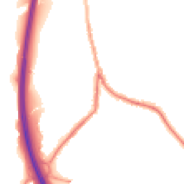 Night-time road noise heatmap for BL0 0JY