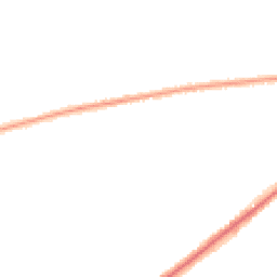 Night-time road noise heatmap for BL8 2LN