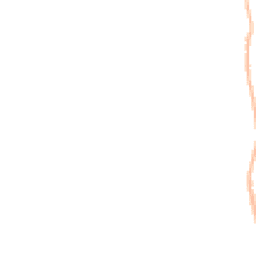 Night-time road noise heatmap for BS31 1AT