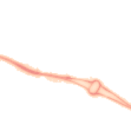 Night-time road noise heatmap for BS34 8QP