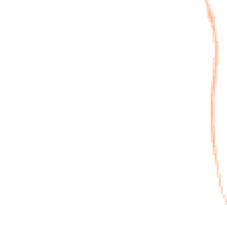 Night-time road noise heatmap for LA18 5JR