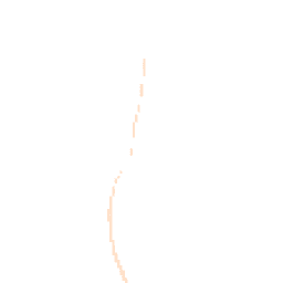 Night-time road noise heatmap for NG34 0NY