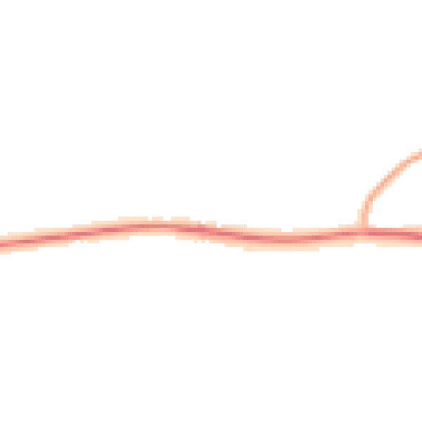 Night-time road noise heatmap for ST5 5AJ