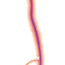 Daytime road noise heatmap for ST7 3TA