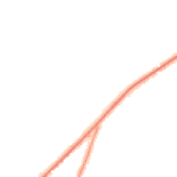 Night-time road noise heatmap for ST9 9LG