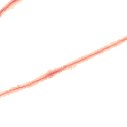 Night-time road noise heatmap for BD18 1DJ