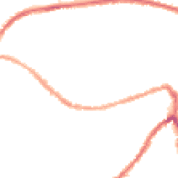Night-time road noise heatmap for BS3 1BJ