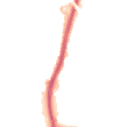 Night-time road noise heatmap for BS34 5BP