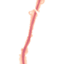 Night-time road noise heatmap for BS34 5BQ